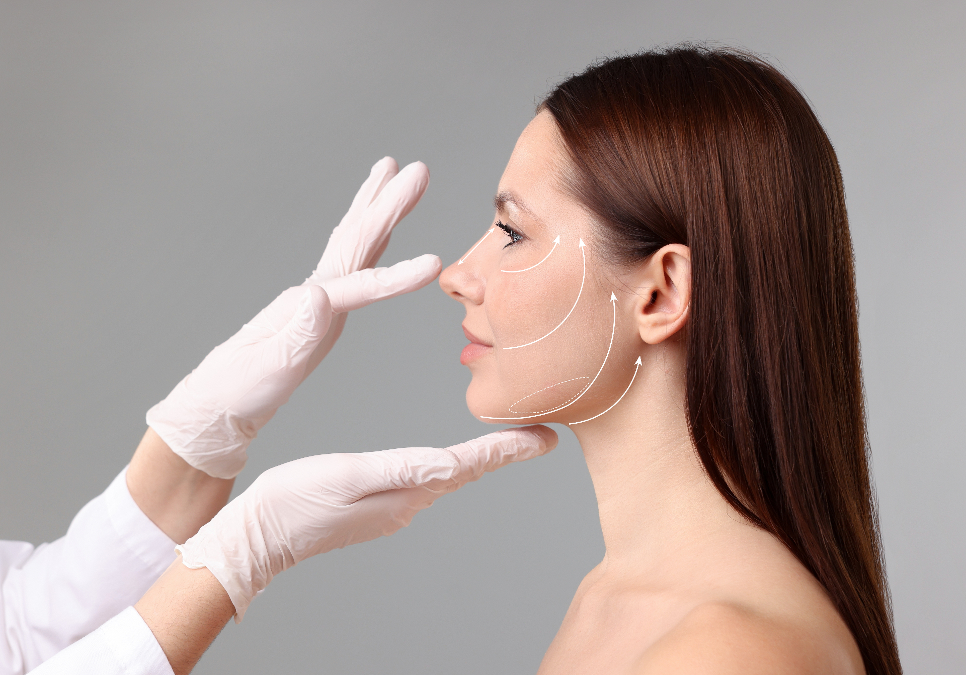 Lifting facial endoscópico: técnica y recuperación