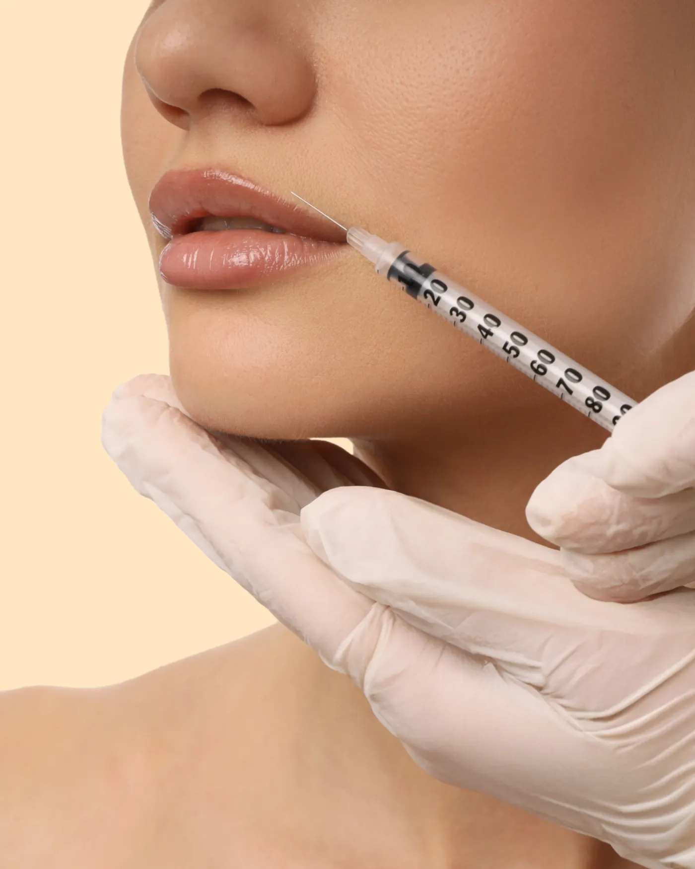 Cirugía cosmética de labios — Dr. Camilo Comba, Costa Rica