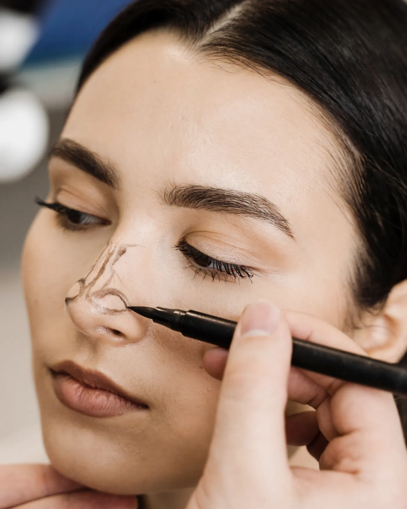 Rinoplastia Estética — Dr. Camilo Comba, Costa Rica
